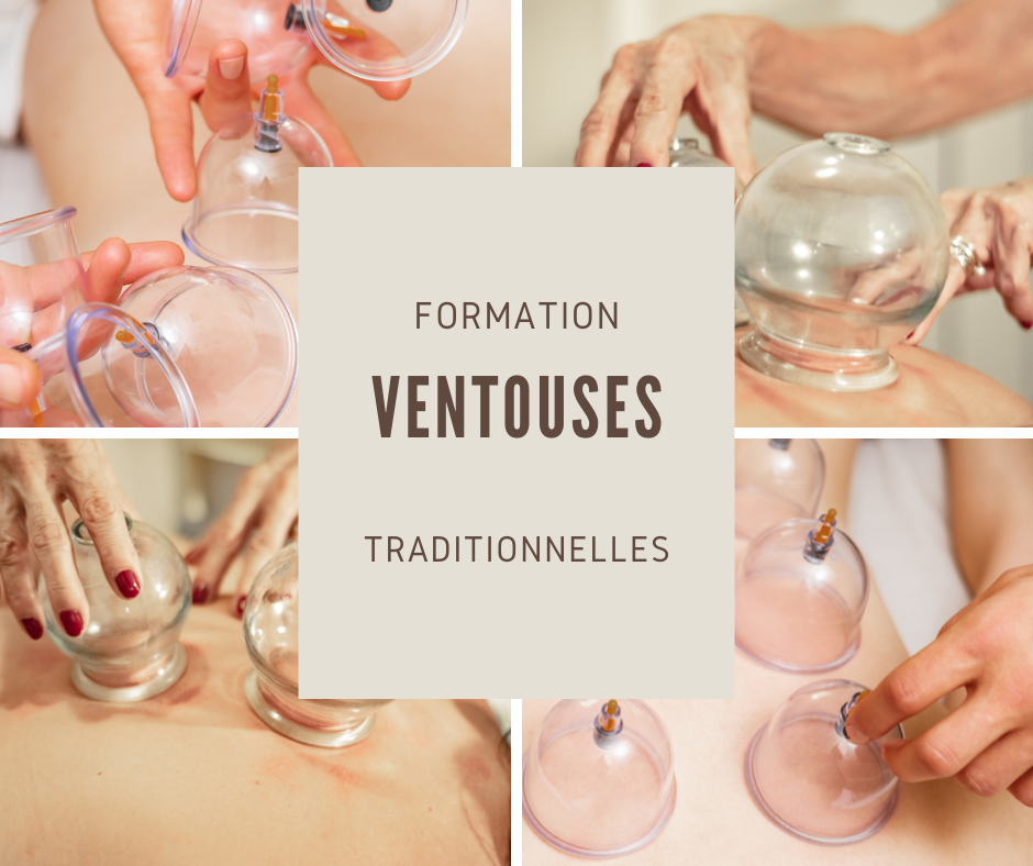 formation ventouse en ligne